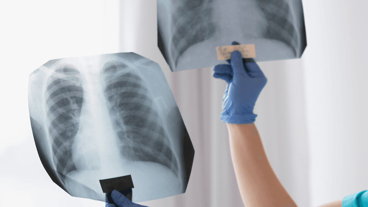 Pneumologia