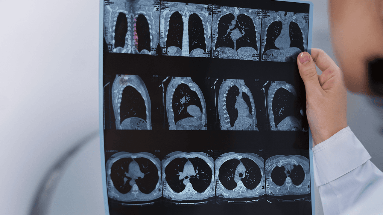 Radiologia